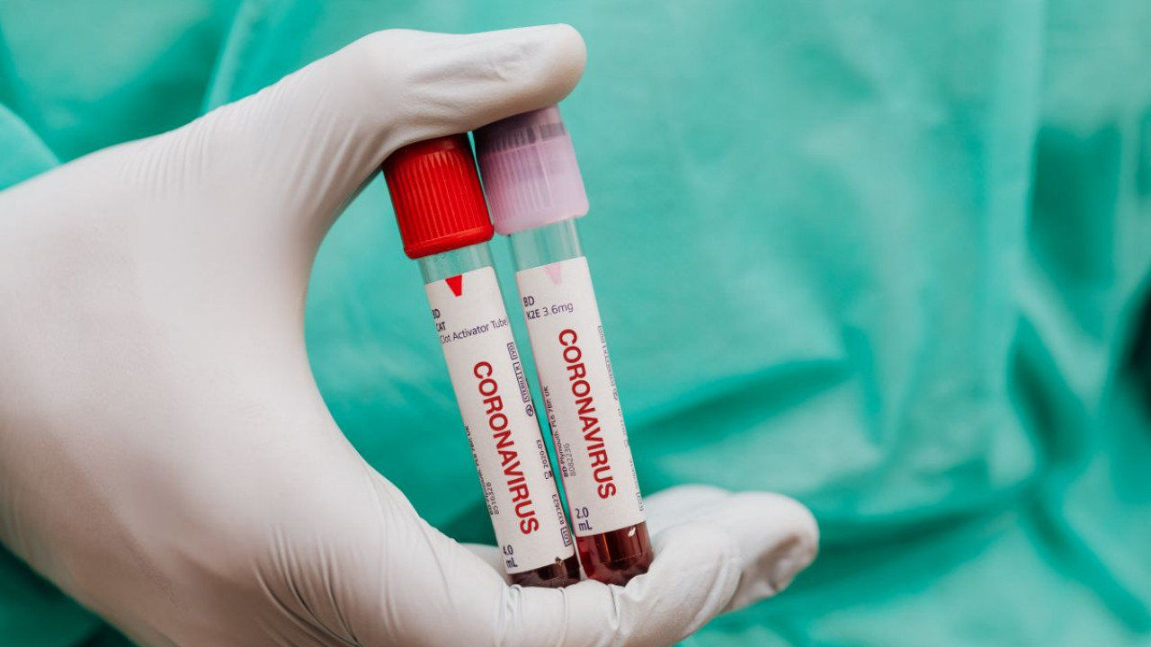 Coronavirus