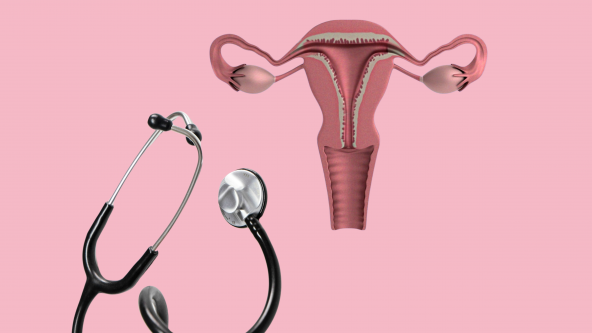 Schwangerschaftsabbruch